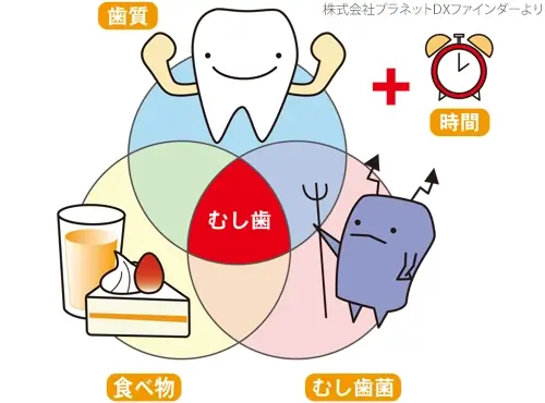 「むし歯になる」ってどういうこと？