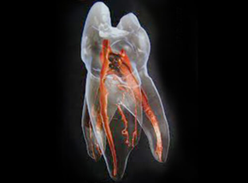 迷路のような神経網